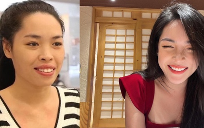 Hot girl phẫu thuật thẩm mỹ Vũ Thanh Quỳnh sau 8 năm “đập đi xây lại”: Sự nghiệp rực rỡ, nhan sắc lên hương nhưng vẫn lẻ bóng