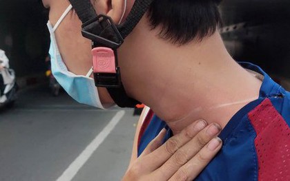 TP.HCM: Nhiều người bị dây diều cứa cổ, ngã chấn thương