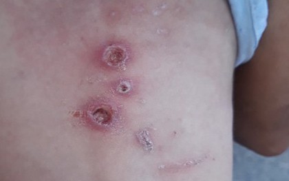 Bé trai 2 tuổi nghi bạo hành tại Hóc Môn hiện ra sao?