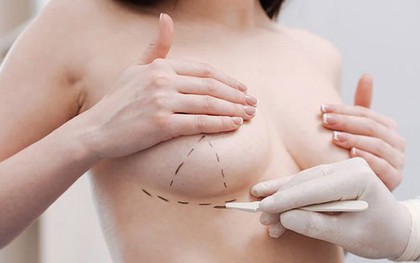 Cảnh giác trước chiêu quảng cáo nâng ngực không cần phẫu thuật