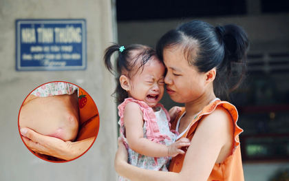 Mẹ bệnh không dám đi chữa trị, gom góp tiền cứu con gái 2 tuổi bị thận ứ nước, suy dinh dưỡng nặng