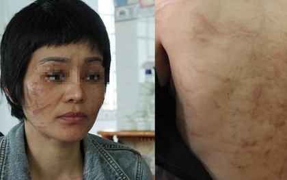 Người chồng bị tố bạo hành vợ bầu 7 tháng như thời trung cổ khai gì?