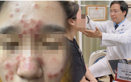 Chi tiền triệu để sở hữu làn da căng bóng, nhận lại khuôn mặt đầy nốt u cục