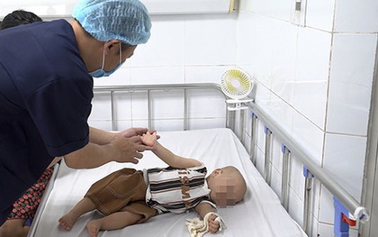 Mắc tay chân miệng chủng virus EV71, trẻ bị biến chứng viêm não