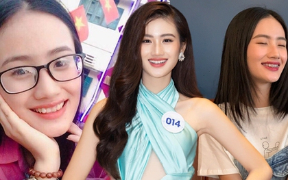 Tân Miss World Việt Nam Huỳnh Nhi “lên đời” nhan sắc nhờ niềng răng