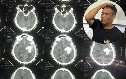 Thông tin về vụ nghi phạm đi cấp cứu sau khi bị tạm giữ tại Công an Đồ Sơn