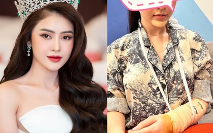 Hoa hậu Lý Kim Thảo bị tai nạn giao thông, phải rời khỏi Miss Universe Vietnam 2023