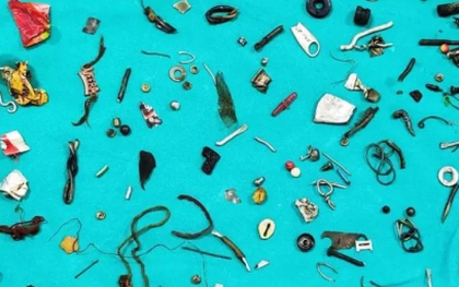 Bác sỹ sốc khi phát hiện cả "nhà kho" gồm 60 món đồ trong bụng bệnh nhân