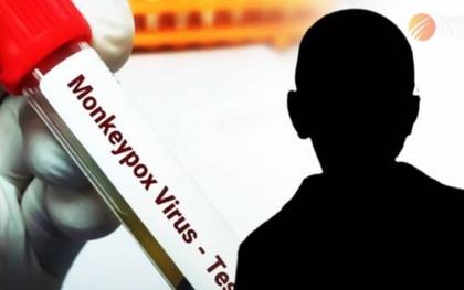 Số ca mắc đậu mùa khỉ tăng đột biến ở thanh thiếu niên Thái Lan