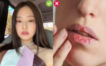 "Kiếp nạn" mùa đông có thể phá bĩnh mọi visual xinh đẹp mang tên: Đôi môi khô tróc, nứt nẻ!