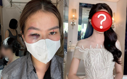 Vụ đi trang điểm đám cưới, thợ makeup tố bị em gái cô dâu "tương tác" bầm tím mắt: Hai bên nói gì?