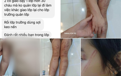 Vụ trẻ mầm non 5 tuổi đánh bạn cùng lớp bầm tím ở Nghệ An: Tạm dừng công tác giáo viên phụ trách