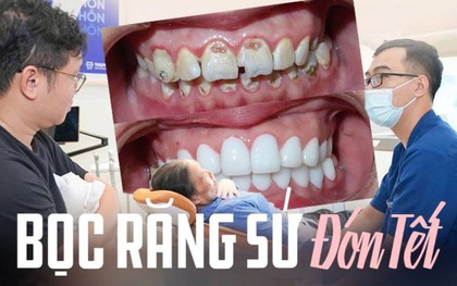 Làm răng sứ đón Tết lúc này có phù hợp? BS chỉ rõ ưu - nhược điểm, giá từng loại tham khảo trước khi làm