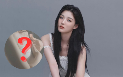 Bức ảnh xấu hổ nhất cuộc đời Kim Yoo Jung