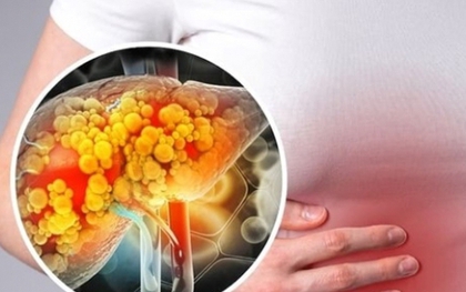 5 loại lá thảo dược là “khắc tinh” của gan nhiễm mỡ, ở Việt Nam cực nhiều