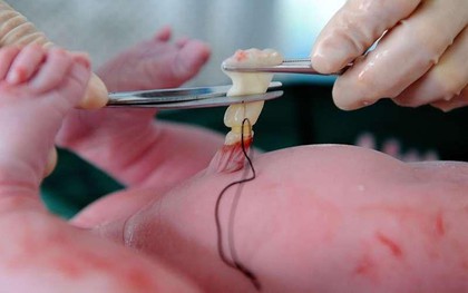 Mang cuống rốn con đi xét nghiệm ADN, đọc kết quả xong tự trách mình ngu