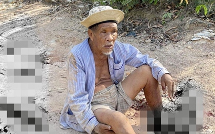 Điều tra vụ cụ ông 85 tuổi bị dập nát 2 bàn chân