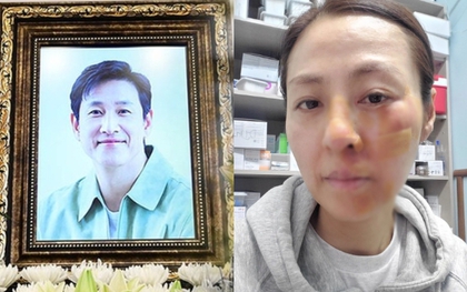 Bi kịch dồn dập: Tài tử Lee Sun Kyun qua đời 3 tháng thì cha mất vì bệnh, giờ đến lượt vợ gặp tai nạn
