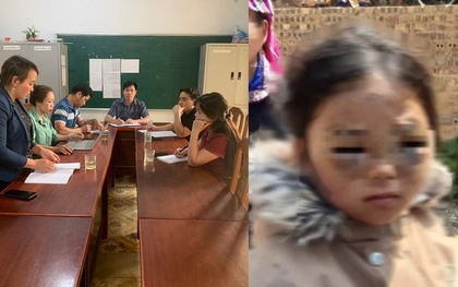 Vụ bé lớp 1 ở Yên Bái bị đánh tím mắt: Thông tin bất ngờ về cô giáo