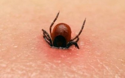 Bác sỹ cảnh báo vết đốt nhỏ từ côn trùng cũng có thể gây chết người