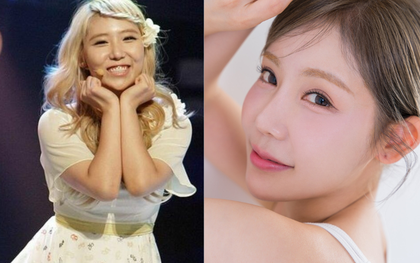 Nữ idol lên hương dù không phẫu thuật thẩm mỹ nhờ 3 tips, chiêu số 2 ai làm cũng được vì không tốn tiền