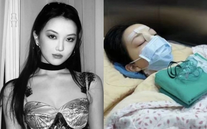 Sau màn khoe visual gây bão MXH, con gái 18 tuổi của diva Vương Phi lên bàn mổ lần 4