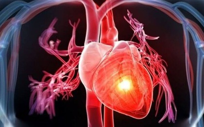 Nếu có những dấu hiệu này, coi chừng bạn đã mắc "hội chứng áo choàng trắng"