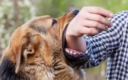 Người đàn ông tử vong sau 2 năm bị chó cắn