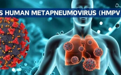 Virus HMPV giống Covid-19 lây kéo dài ở Trung Quốc khi chưa có thuốc điều trị