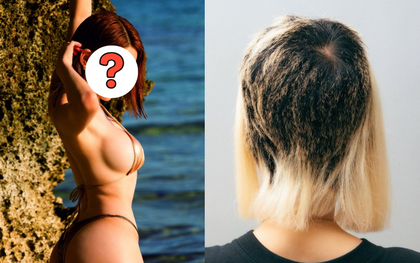 Nữ DJ suy sụp bật khóc, tóc rụng mảng lớn