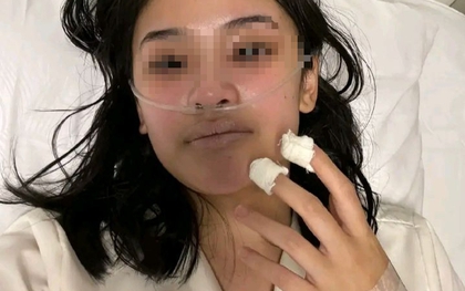 Những người có 6 thứ này màu đen thường "lành ít dữ nhiều", ung thư đang "gặm nhấm" cơ thể