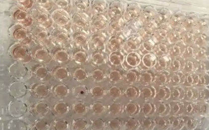 Phát hiện người mang máu kim cương