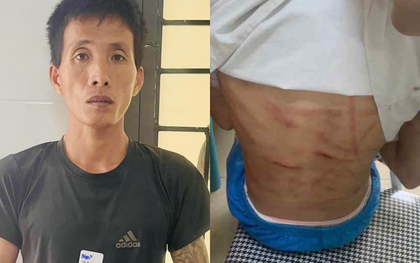 Lời khai của Nguyễn Văn Nam - gã cha dượng đánh đập bé gái lớp 5 dã man