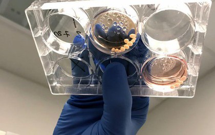 Lịch sử loài người thay đổi vì một chất độc