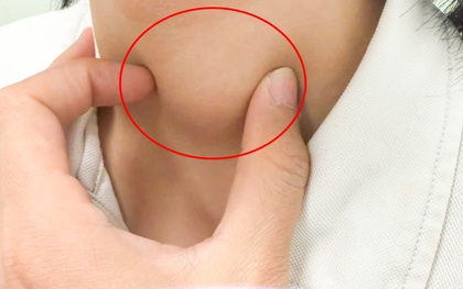 Bé trai 13 tuổi mắc ung thư tuyến giáp, phát triển nhanh chỉ trong vài tuần