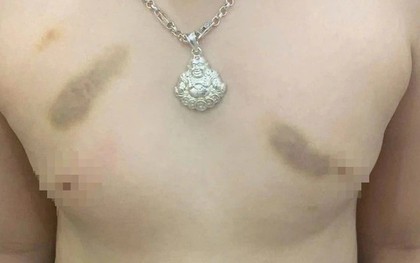 Phụ huynh tố giáo viên mầm non bạo hành trẻ, yêu cầu bồi thường 1 năm học phí?