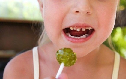 Bánh kẹo ngọt có phải là "thủ phạm" gây sâu răng sữa sớm ở trẻ
