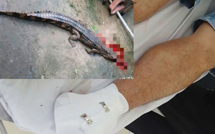 Thầy giáo ở Tây Ninh bị cá sấu sổng chuồng cắn vào chân