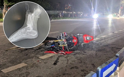 Kỳ tích 6 tiếng nối lại chân cho cô gái 19 tuổi sau tai nạn kinh hoàng với xe phân khối lớn ở Hà Nội