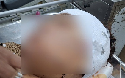 Đồng Tháp: Nữ cán bộ phường khai lý do rạch mặt người phụ nữ nhậu với chồng