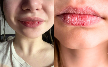 30 tuổi nhận ra dưỡng môi kiểu cũ không hiệu quả: 6 điều bạn cần thay đổi ngay khi trời lạnh