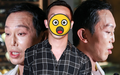 "Hoàng tử showbiz" bị vỡ nát gương mặt, phẫu thuật hơn 10 lần để sửa dung mạo méo mó biến dạng