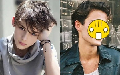 "Cậu bé đẹp nhất thế giới" giờ ra sao?