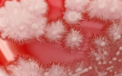 Người đàn ông "họng trắng như tuyết" vì thói quen này của nhiều người