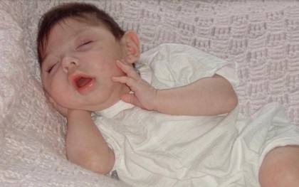 Cô bé sinh ra không có não bây giờ ra sao?