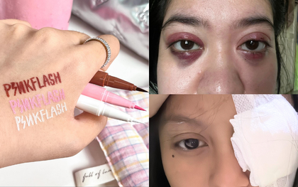 Phấn mắt PINKFLASH dính bê bối lớn: Người dùng bị lẹo mắt hàng loạt, hãng tiêu huỷ, đền tiền gấp đôi