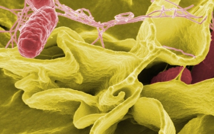 Vi khuẩn Salmonella gây ngộ độc thực phẩm nguy hiểm thế nào?