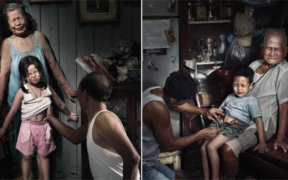 Bộ ảnh gây chấn động: "Nỗi đau theo suốt một đời"