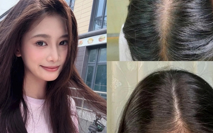 5 xịt mọc tóc "made in Vietnam" để tóc chắc khỏe từ gốc, không lo gãy rụng
