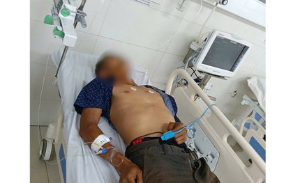 Ngộ độc sau khi ăn bọ xít, một bệnh nhân nguy kịch